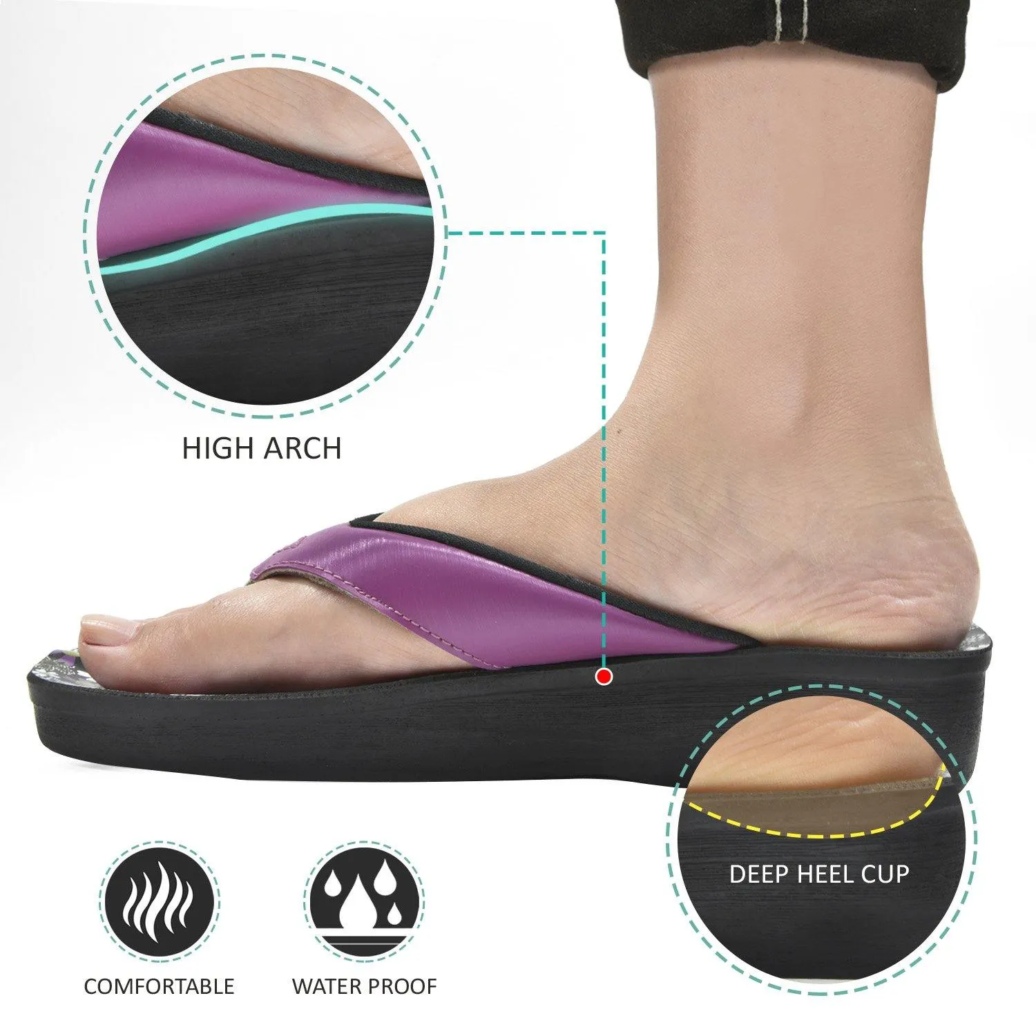 New Flip Or Flop Show Aerosoft - Anette A0815 Floral Summer Vacation Essentials Arch Support Flip Flops For Women